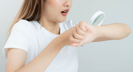 Image representing Common Skin Conditions Decoded: Understanding and Treating Acne, Eczema, and Psoriasis