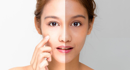 Image representing Why Is My Face Turning Dark? Understanding Facial Melanosis and Hyperpigmentation
